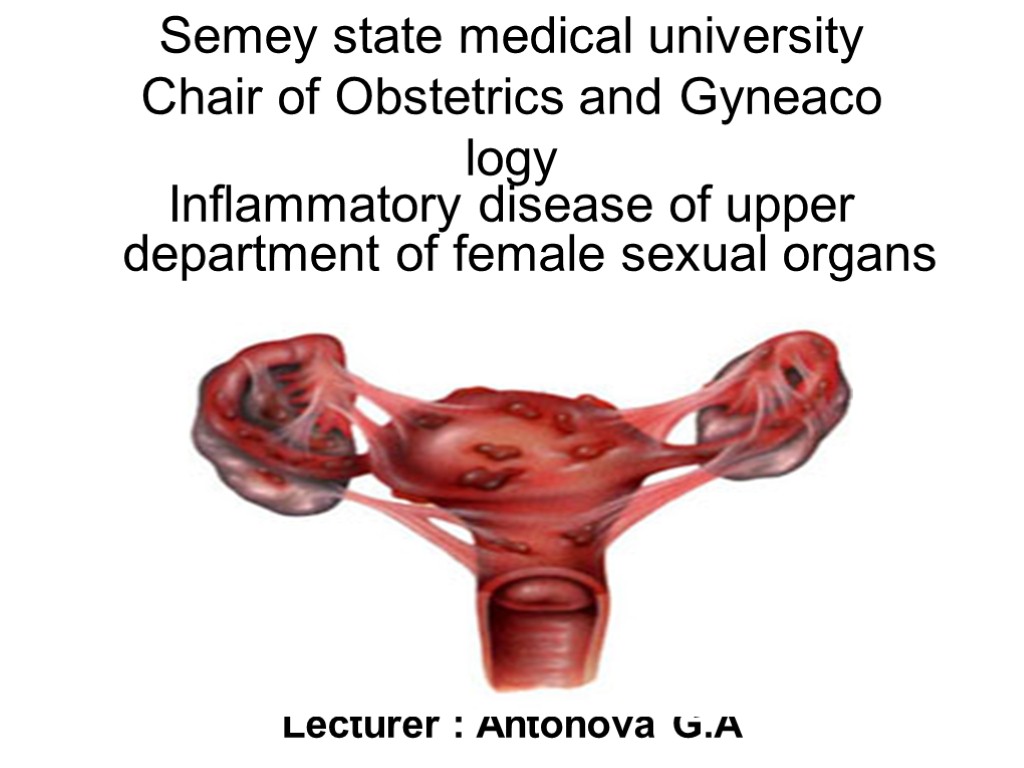 Semey state medical university Chair of Obstetrics and Gyneaco logy Inflammatory disease of upper